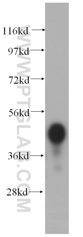 WB analysis of human liver using 14827-1-AP