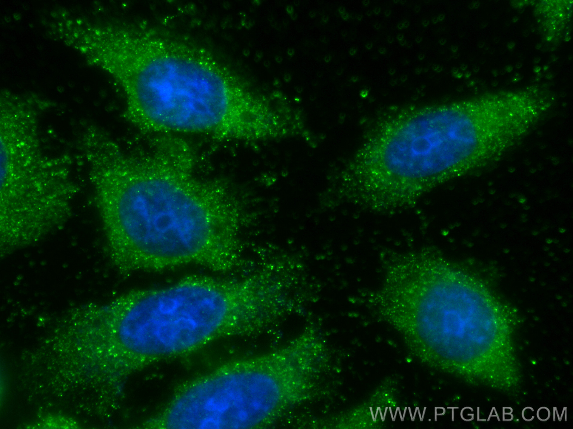 IF Staining of HepG2 using 68355-1-Ig