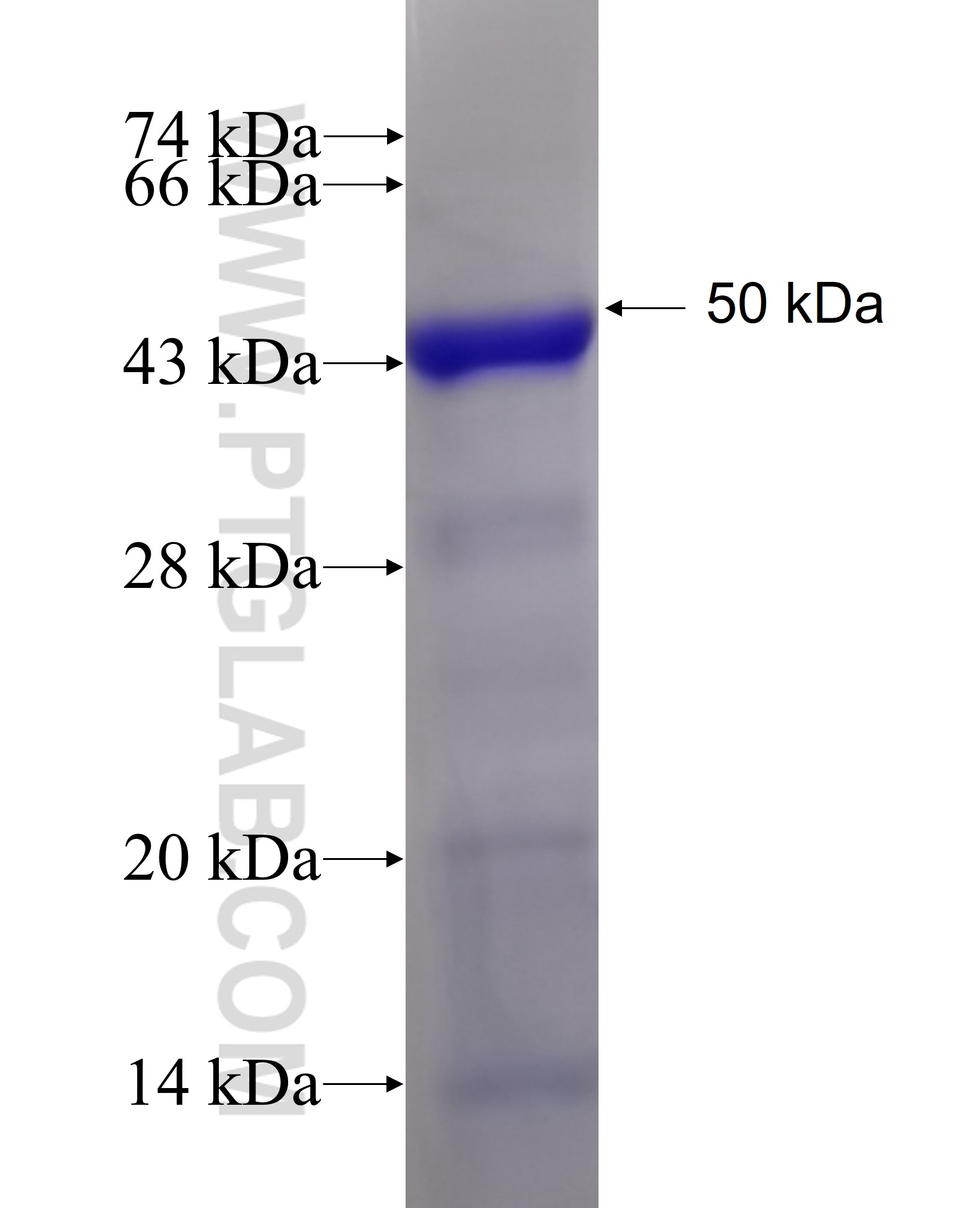 PCYT2 fusion protein Ag6604 SDS-PAGE