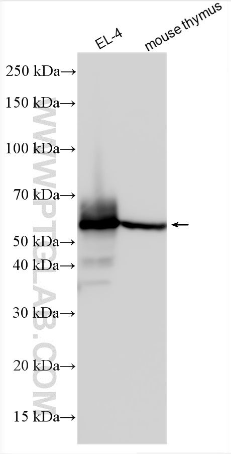 WB analysis using 31445-1-AP