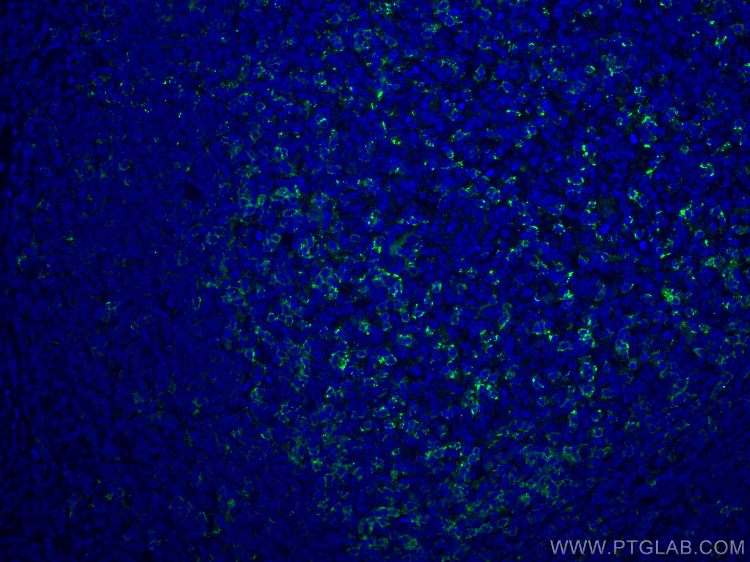 IF Staining of human tonsillitis using 66220-1-Ig (same clone as 66220-1-PBS)