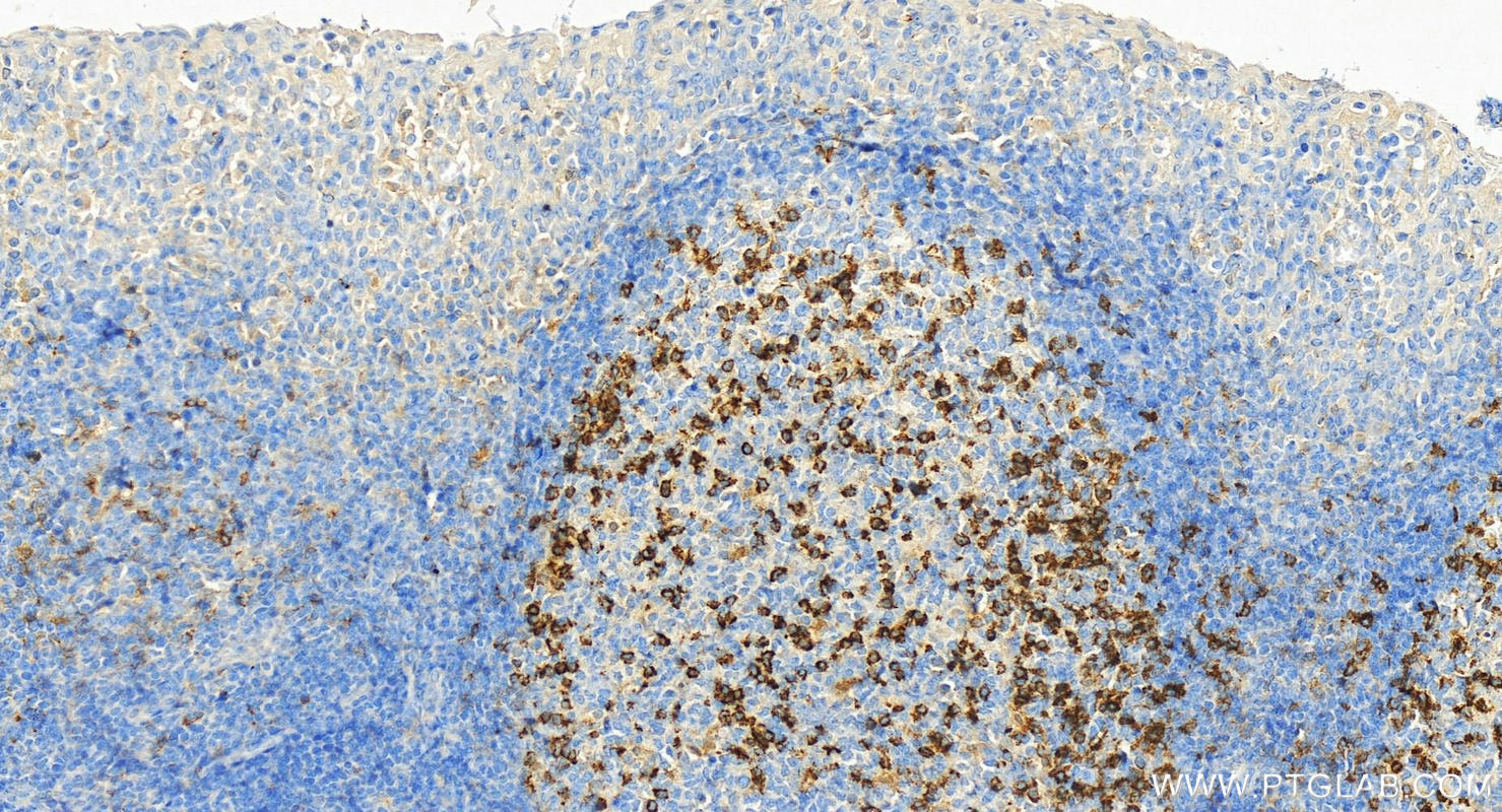 Immunohistochemical analysis of paraffin-embedded human tonsillitis tissue slide using 66220-1-Ig (PD-1/CD279 antibody) at dilution of 1:4000 (under 20x lens). Heat mediated antigen retrieval with Tris-EDTA buffer (pH 9.0). IHC staining of human tonsillitis using 66220-1-Ig