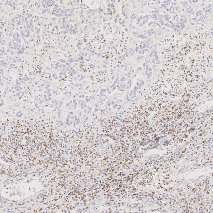 IHC staining of human liver using 98068-1-RR (same clone as 98068-1-PBS) IHC staining of human liver using 98068-1-RR (same clone as 98068-1-PBS)