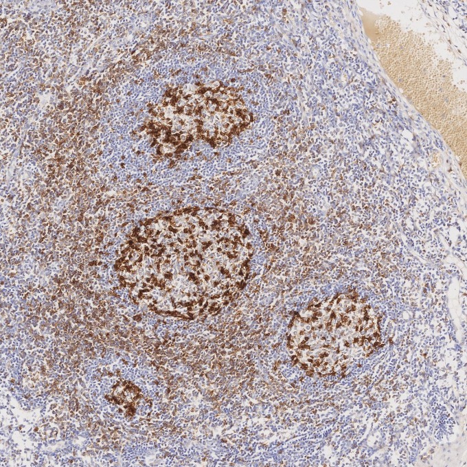 IHC staining of human tonsillitis using 98068-1-RR (same clone as 98068-1-PBS) IHC staining of human tonsillitis using 98068-1-RR (same clone as 98068-1-PBS)