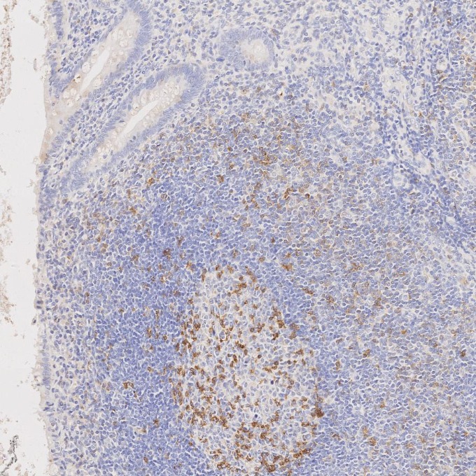 IHC staining of human appendicitis using 98068-1-RR (same clone as 98068-1-PBS) IHC staining of human appendicitis using 98068-1-RR (same clone as 98068-1-PBS)