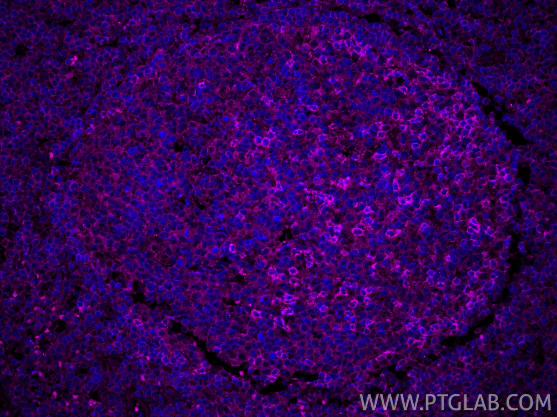 IF Staining of human tonsillitis using APC-66220
