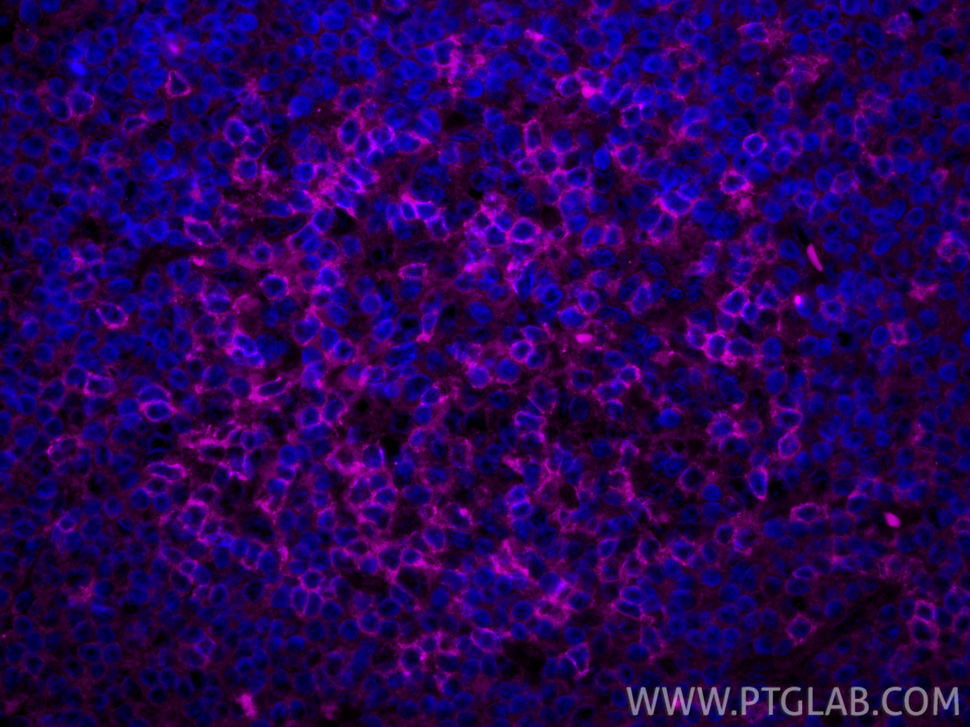 IF Staining of human tonsillitis using APC-66220