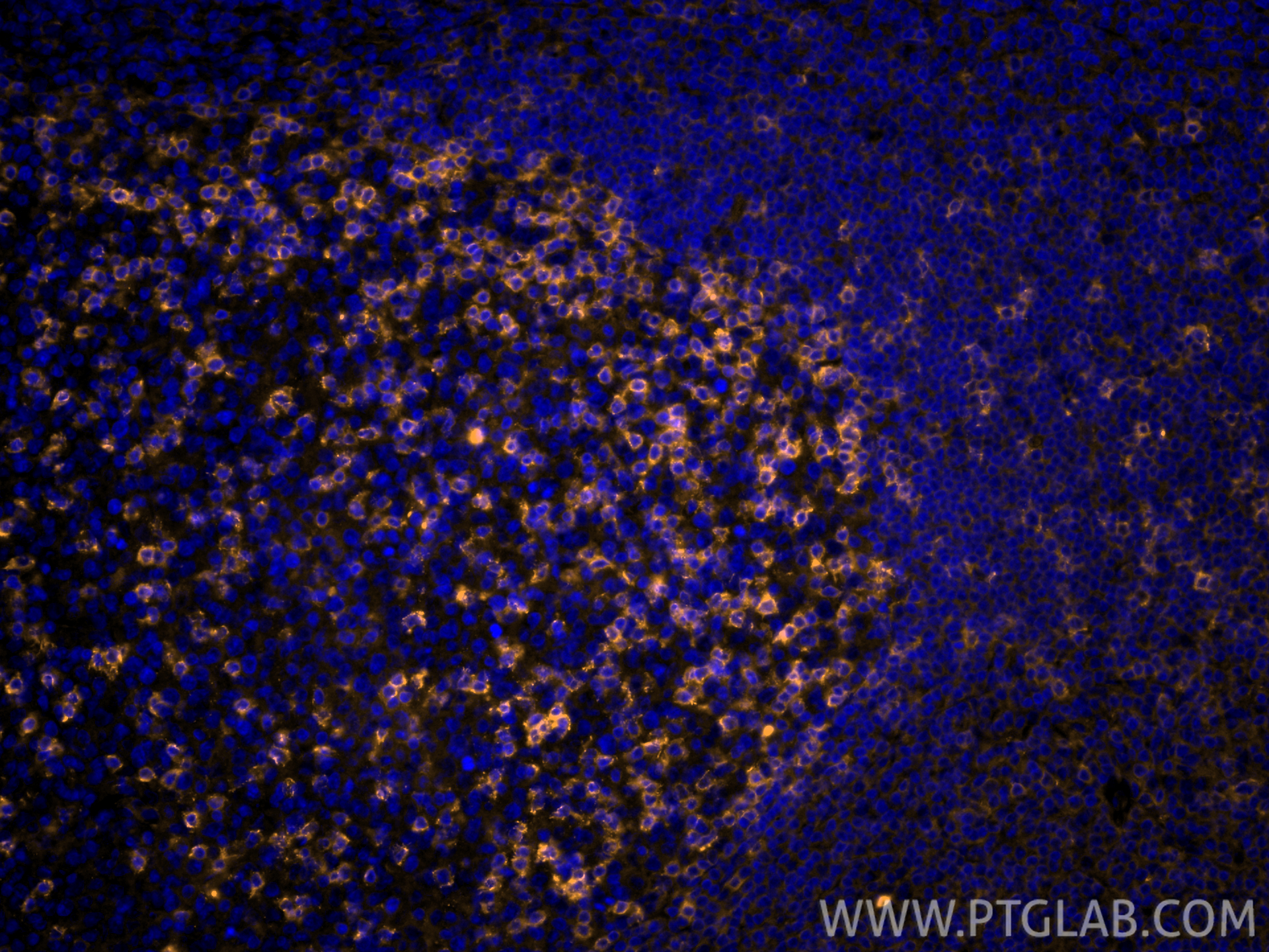 IF Staining of human tonsillitis using CL555-66220