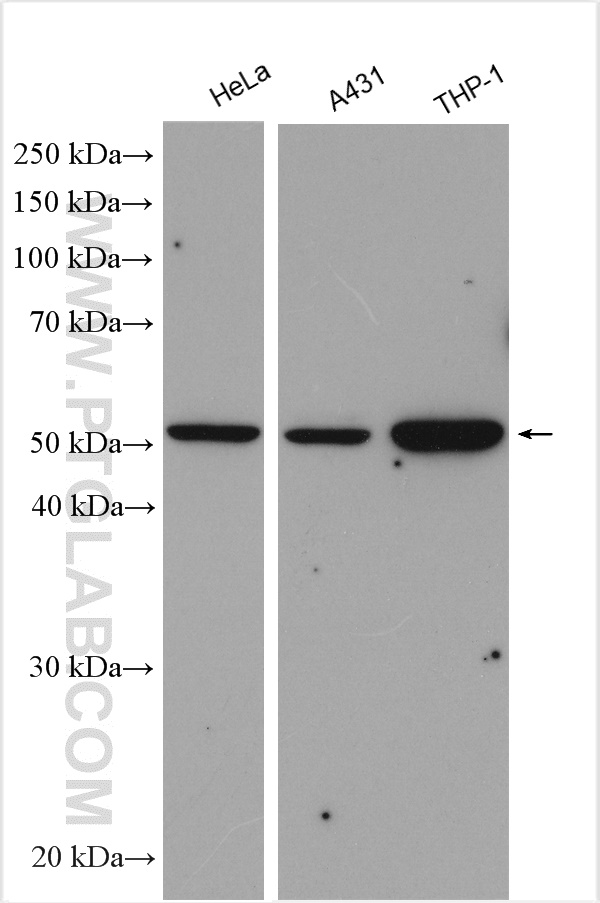 WB analysis using 12383-1-AP