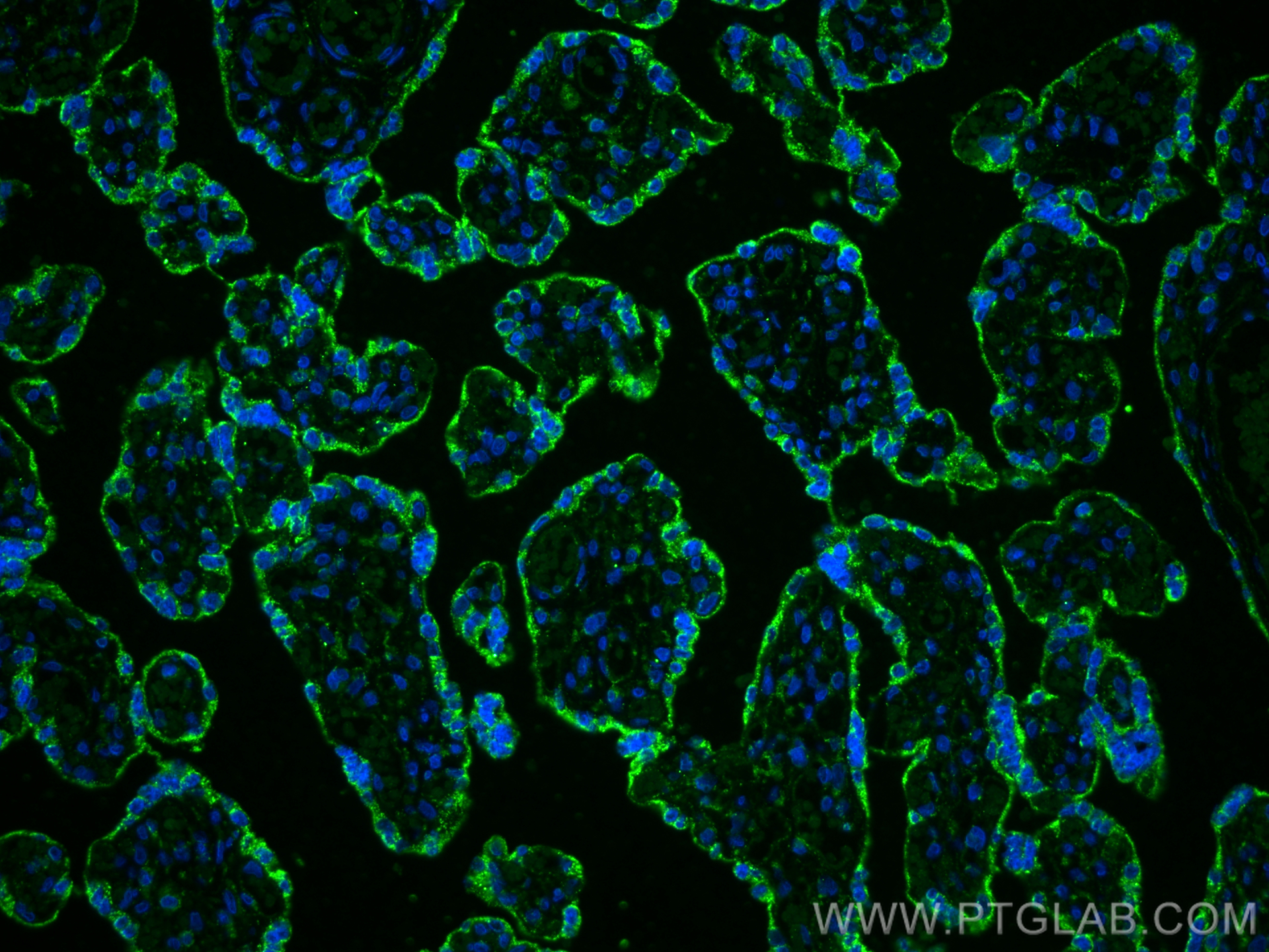 IF Staining of human placenta using 83906-6-RR (same clone as 83906-6-PBS)