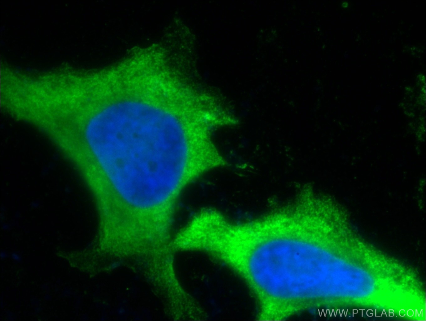 IF Staining of HeLa using 66248-1-Ig (same clone as 66248-1-PBS)