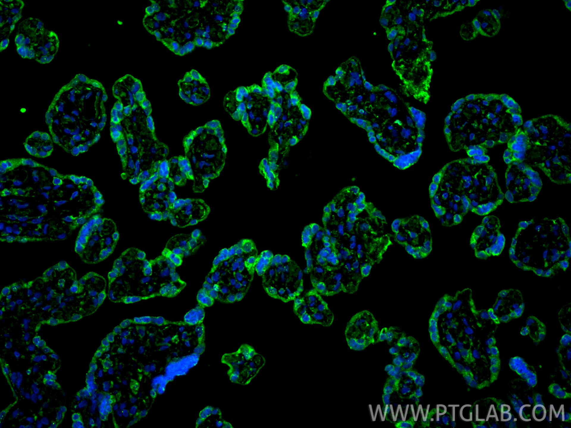 IF Staining of human placenta using 66248-1-Ig (same clone as 66248-1-PBS)