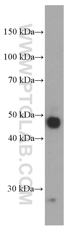 WB analysis of human placenta using 66248-1-Ig (same clone as 66248-1-PBS)