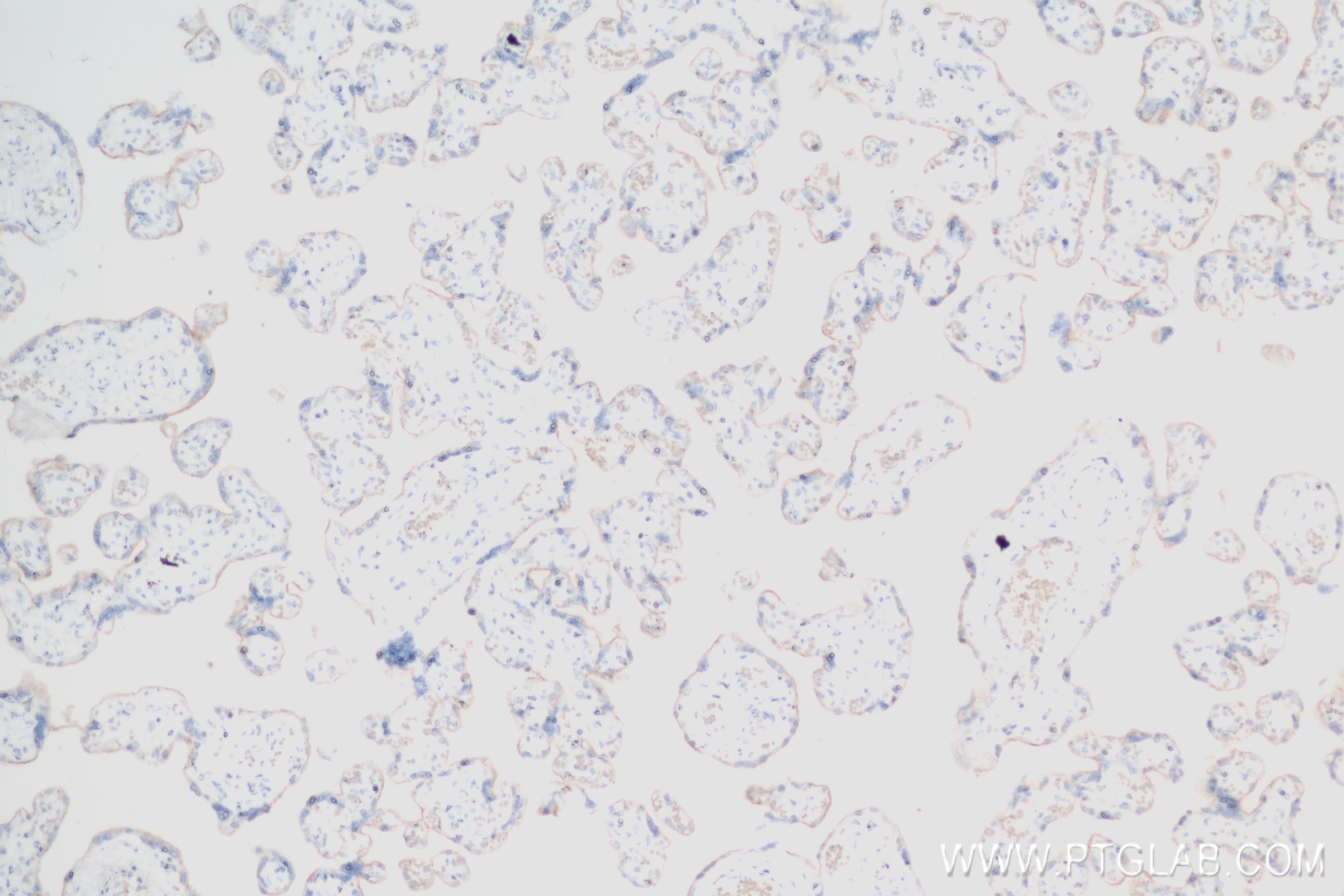 IHC staining of human placenta using 83600-2-RR (same clone as 83600-2-PBS)
