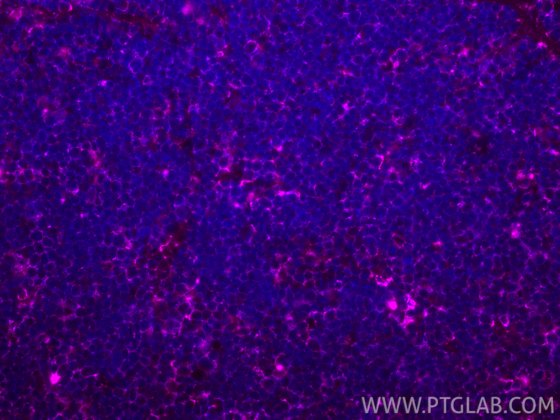 IF Staining of mouse thymus using APC-66248 IF Staining of mouse thymus using APC-66248