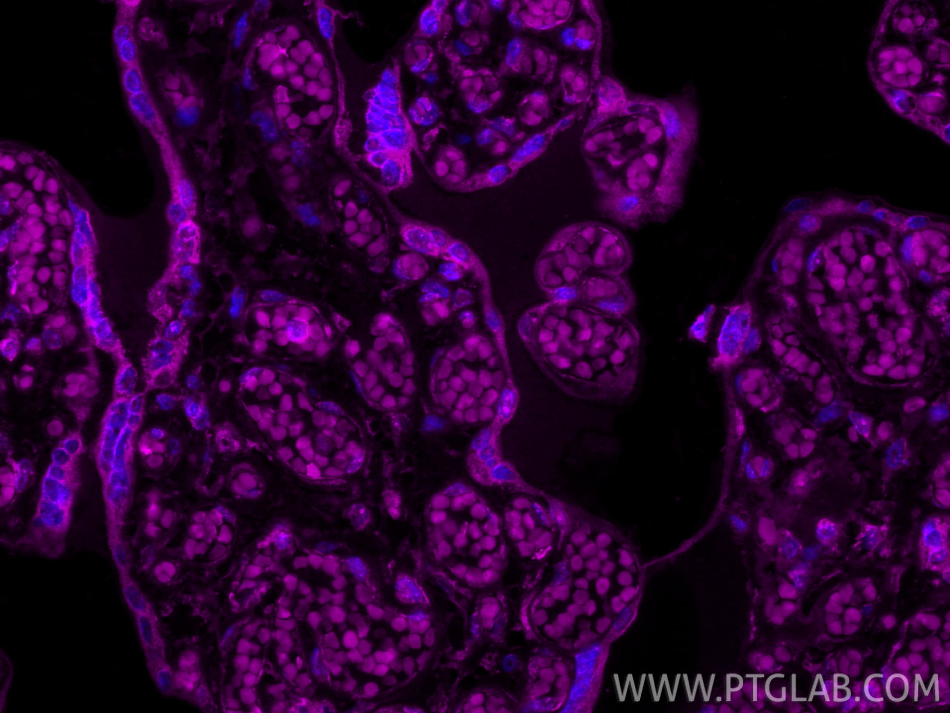 IF Staining of human placenta using CL647-66248