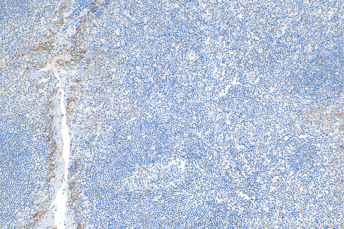 IHC staining of human tonsillitis using Biotin-28076