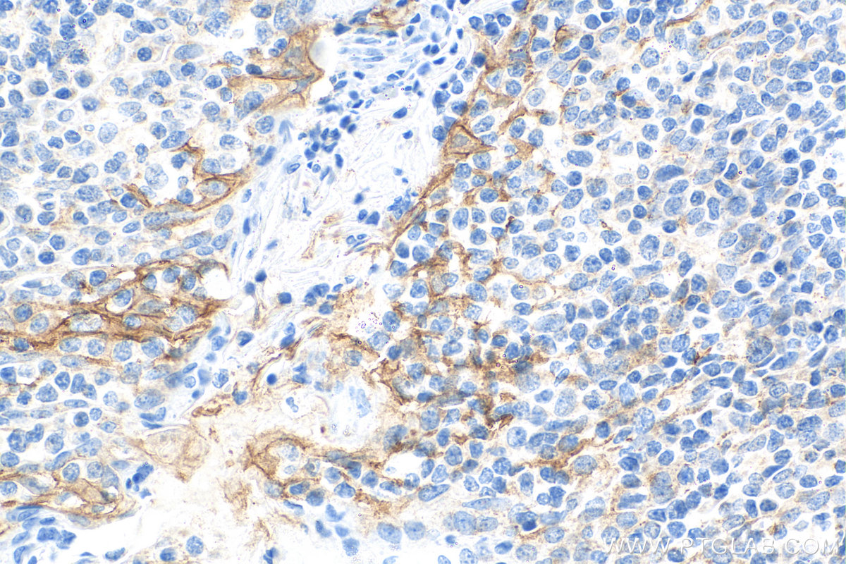 IHC staining of human tonsillitis using Biotin-28076