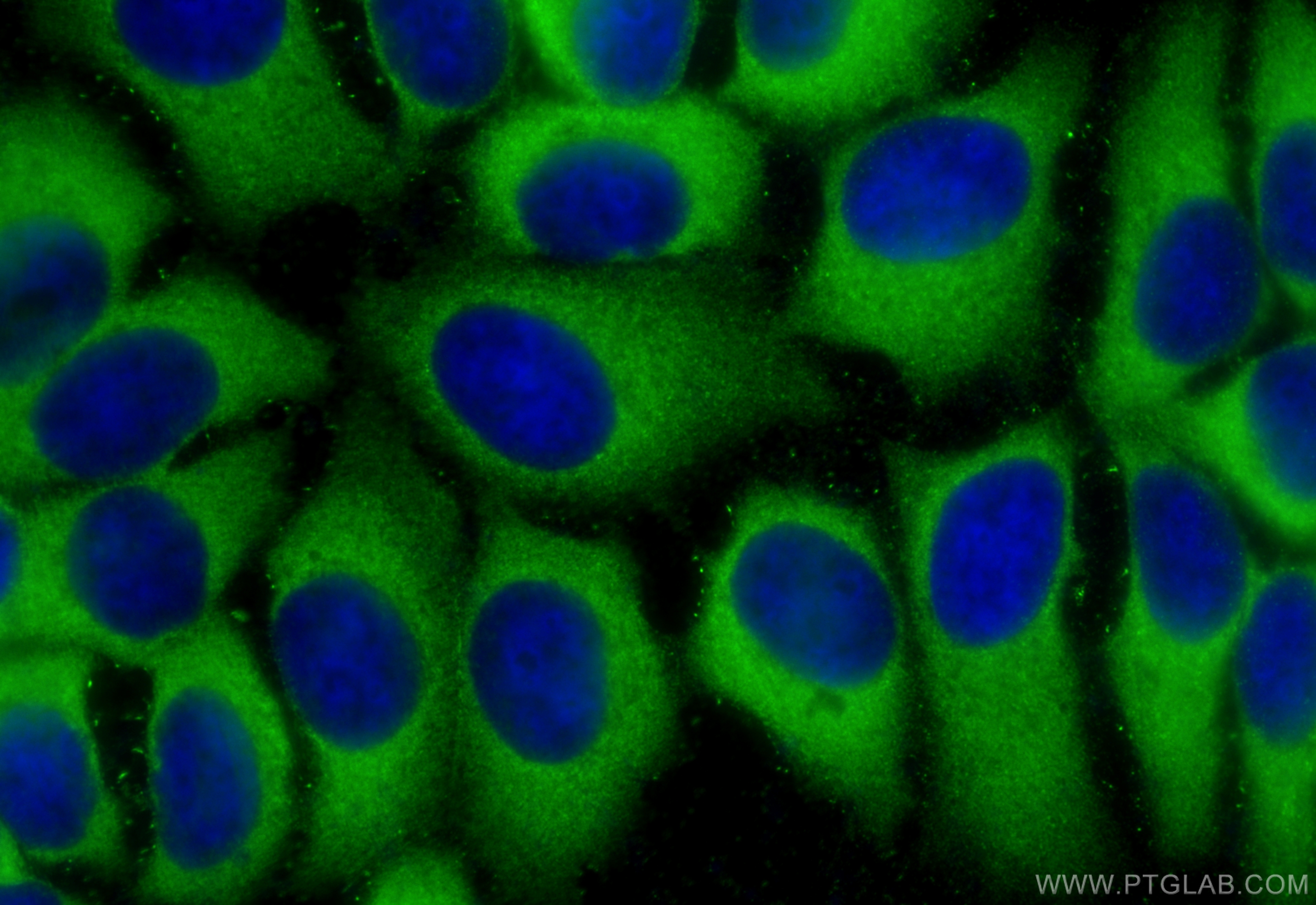 IF Staining of MCF-7 using 15081-1-AP