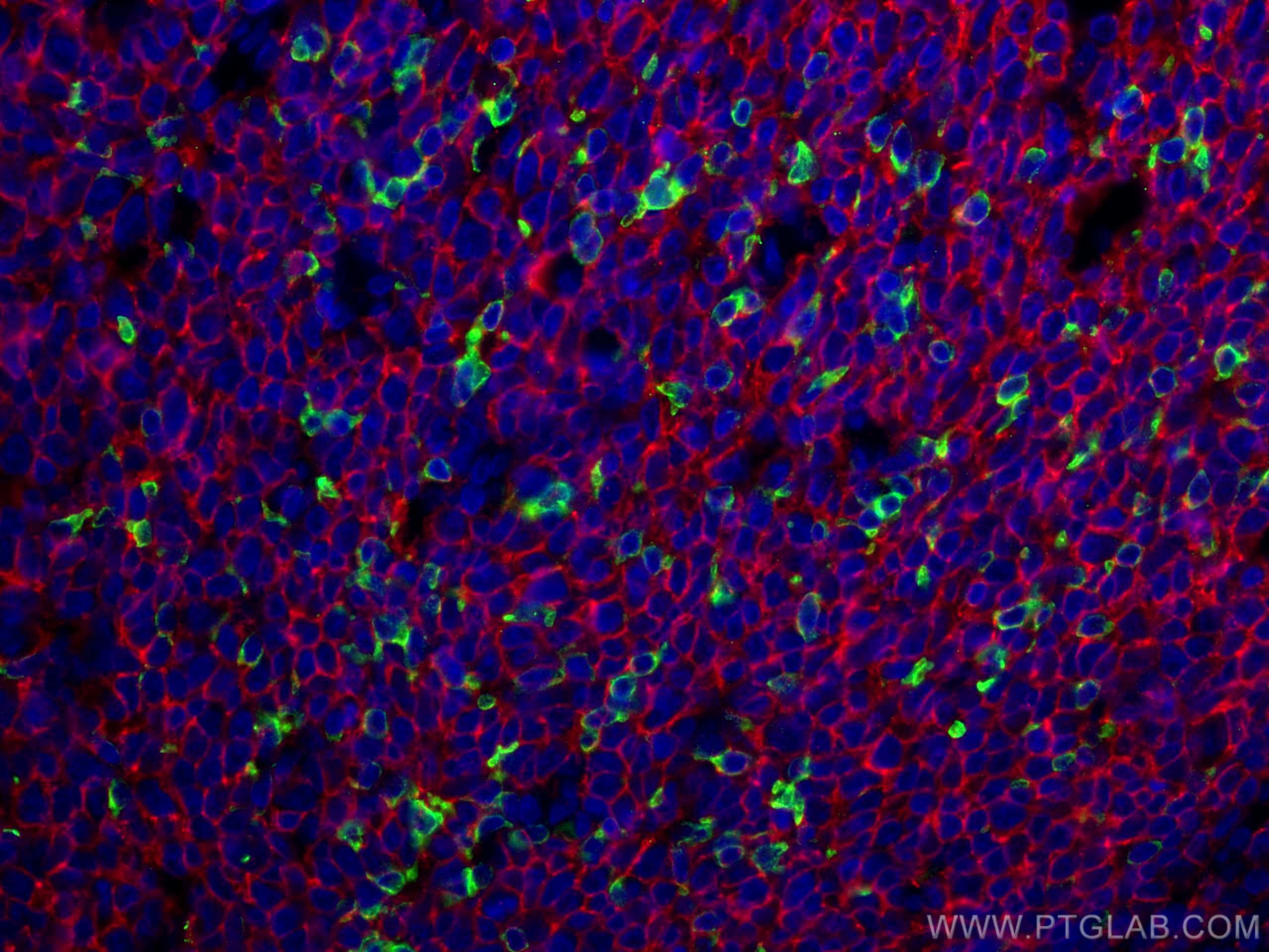 IF Staining of human tonsillitis using 18106-1-AP