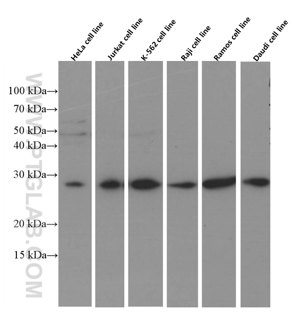 CCM3/PDCD10