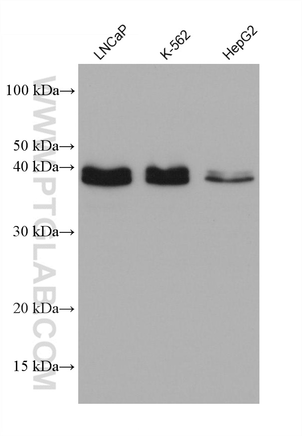 WB analysis using 68249-1-Ig