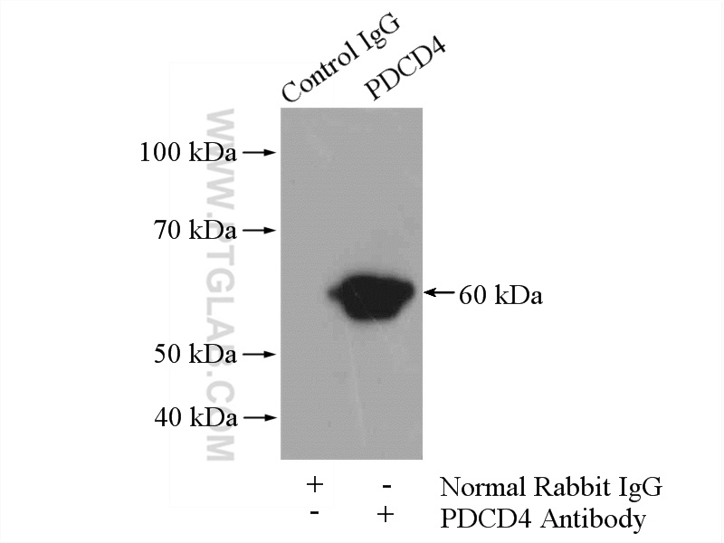 IP experiment of HeLa using 12587-1-AP