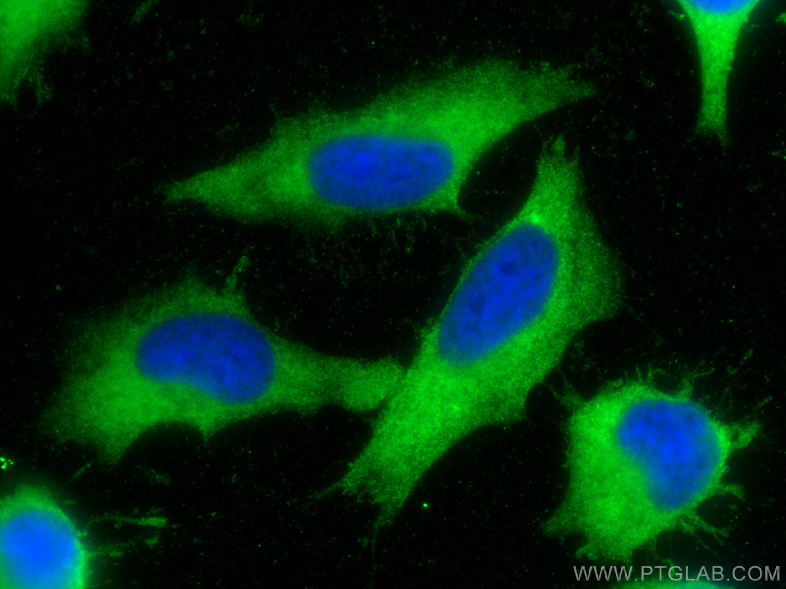 IF Staining of HeLa using 12422-1-AP