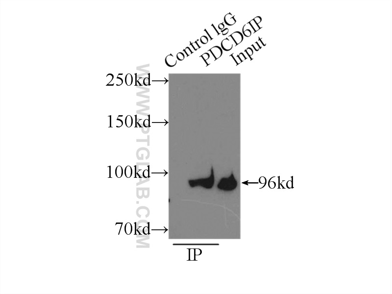 IP experiment of Jurkat using 12422-1-AP