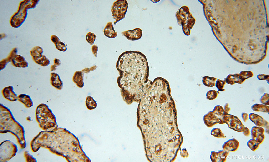 IHC staining of human placenta using 16057-1-AP