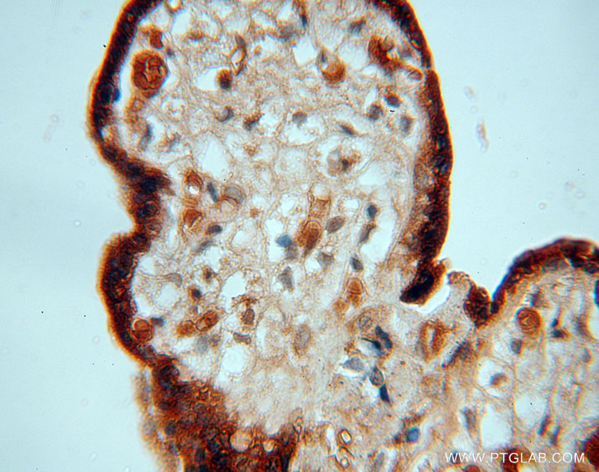 IHC staining of human placenta using 16057-1-AP