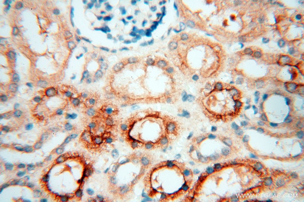 IHC staining of human kidney using 17407-1-AP