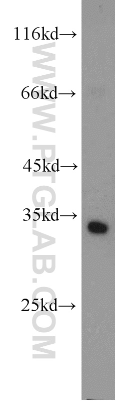 WB analysis of mouse testis using 17407-1-AP