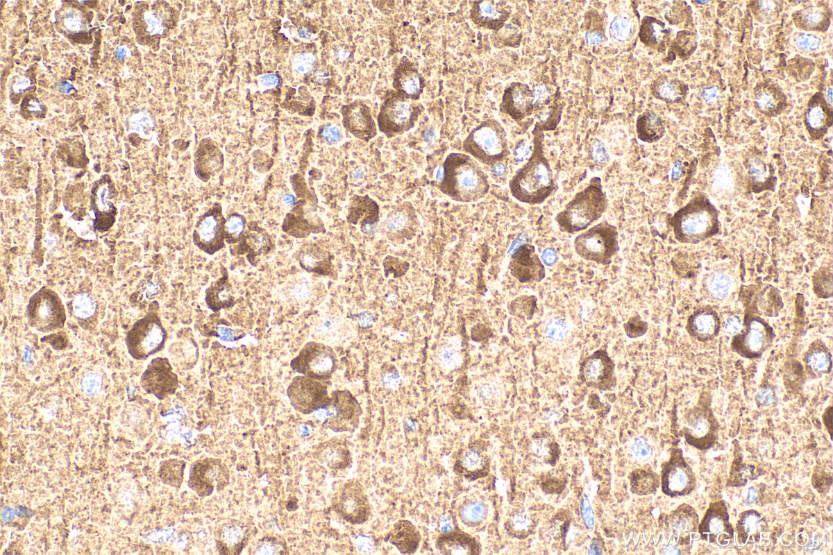 Immunohistochemical analysis of paraffin-embedded mouse brain tissue slide using 12442-2-AP (PDE1A antibody) at dilution of 1:400 (under 40x lens). Heat mediated antigen retrieval with Tris-EDTA buffer (pH 9.0). IHC staining of mouse brain using 12442-2-AP