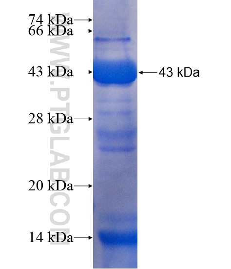 PDE1A fusion protein Ag20307 SDS-PAGE PDE1A fusion protein Ag20307 SDS-PAGE