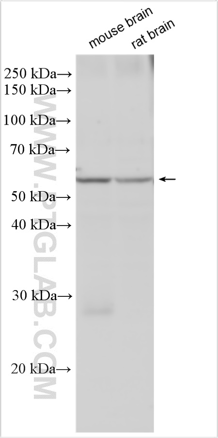 PDE1B