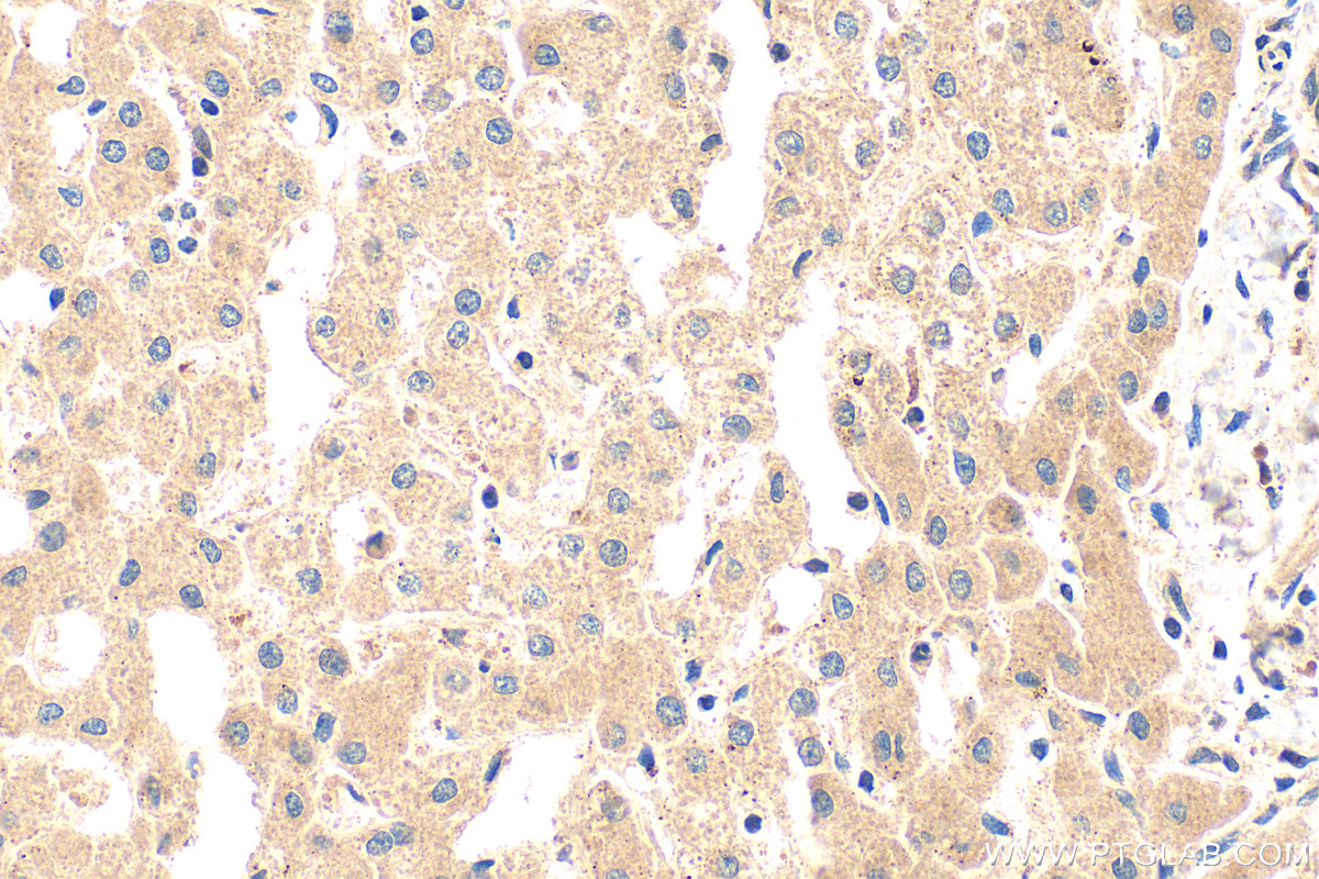 IHC staining of human liver using 13785-1-AP