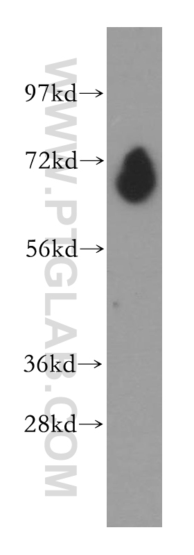 PDE1C