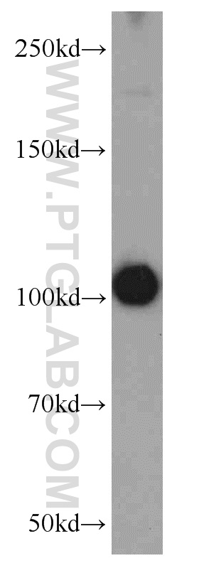 WB analysis of mouse brain using 55306-1-AP