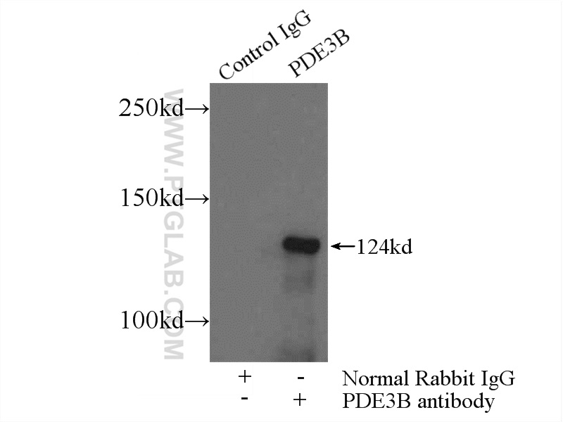 IP experiment of HeLa using 25290-1-AP