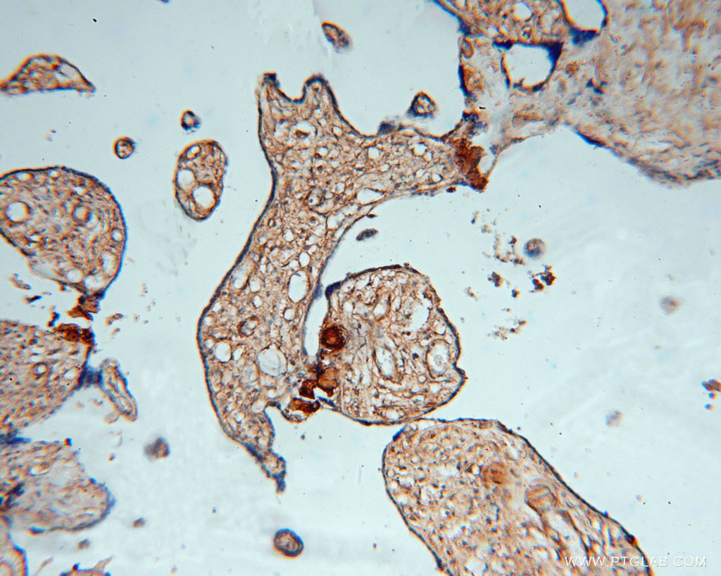 IHC staining of human placenta using 16226-1-AP