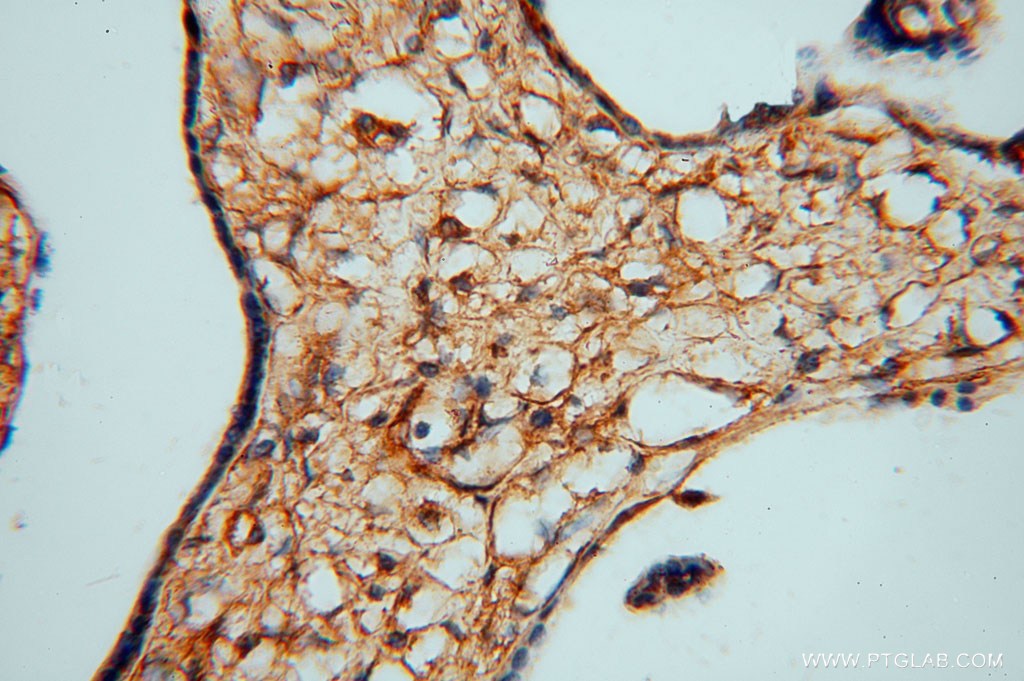 IHC staining of human placenta using 16226-1-AP