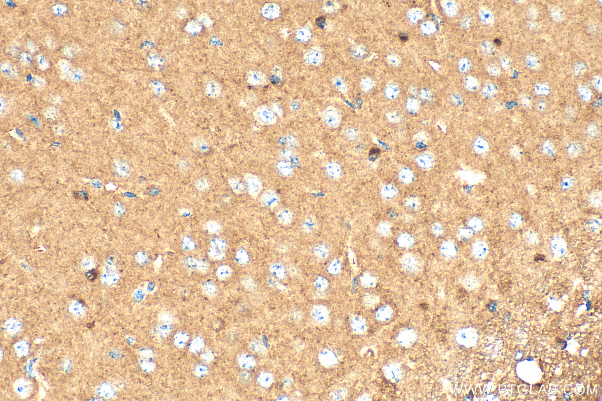 Immunohistochemical analysis of paraffin-embedded mouse brain tissue slide using 31730-1-AP (PDE4B antibody) at dilution of 1:400 (under 40x lens). Heat mediated antigen retrieval with Tris-EDTA buffer (pH 9.0). IHC staining of mouse brain using 31730-1-AP