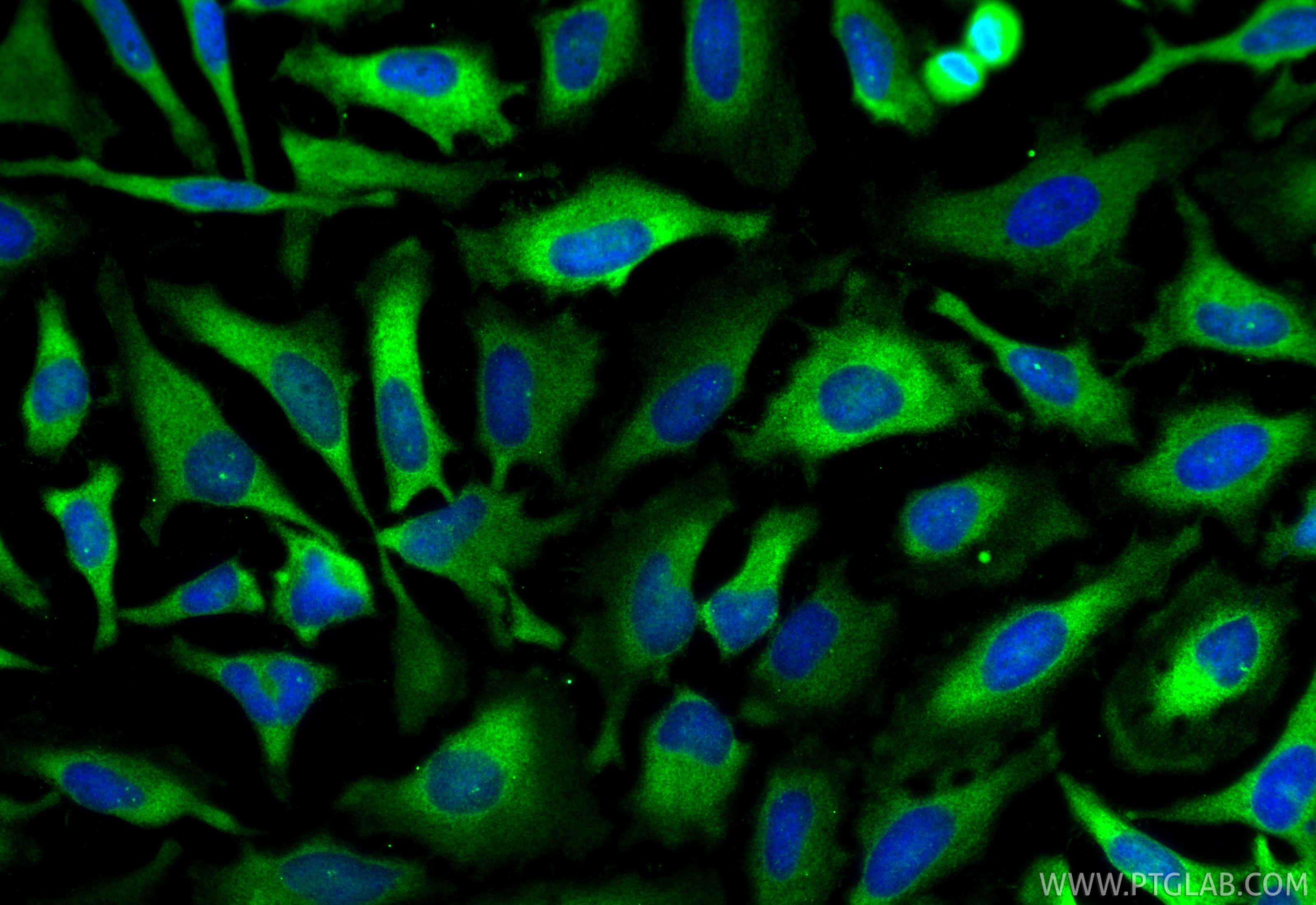 IF Staining of HeLa using 12918-1-AP IF Staining of HeLa using 12918-1-AP