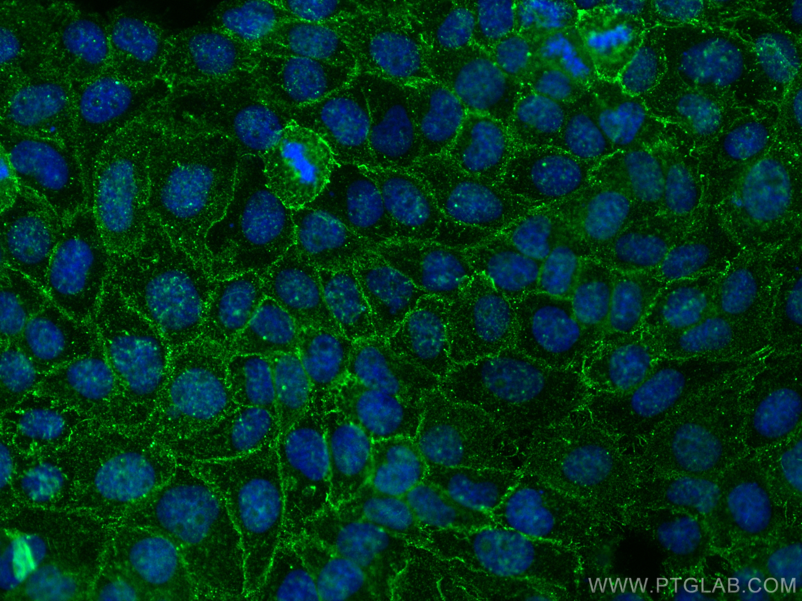 IF Staining of A431 using 67062-1-Ig (same clone as 67062-1-PBS)