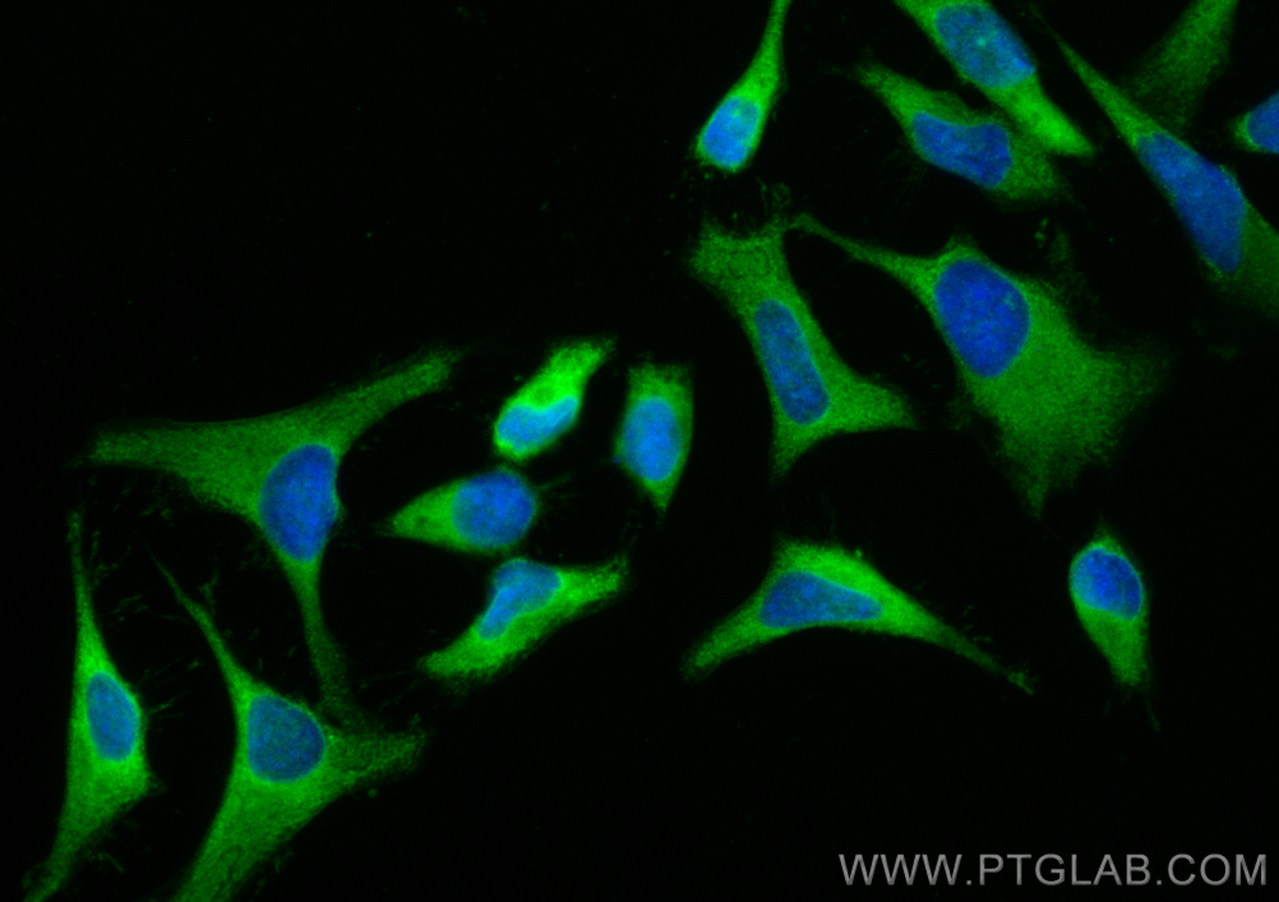 IF Staining of HeLa using CL488-12918