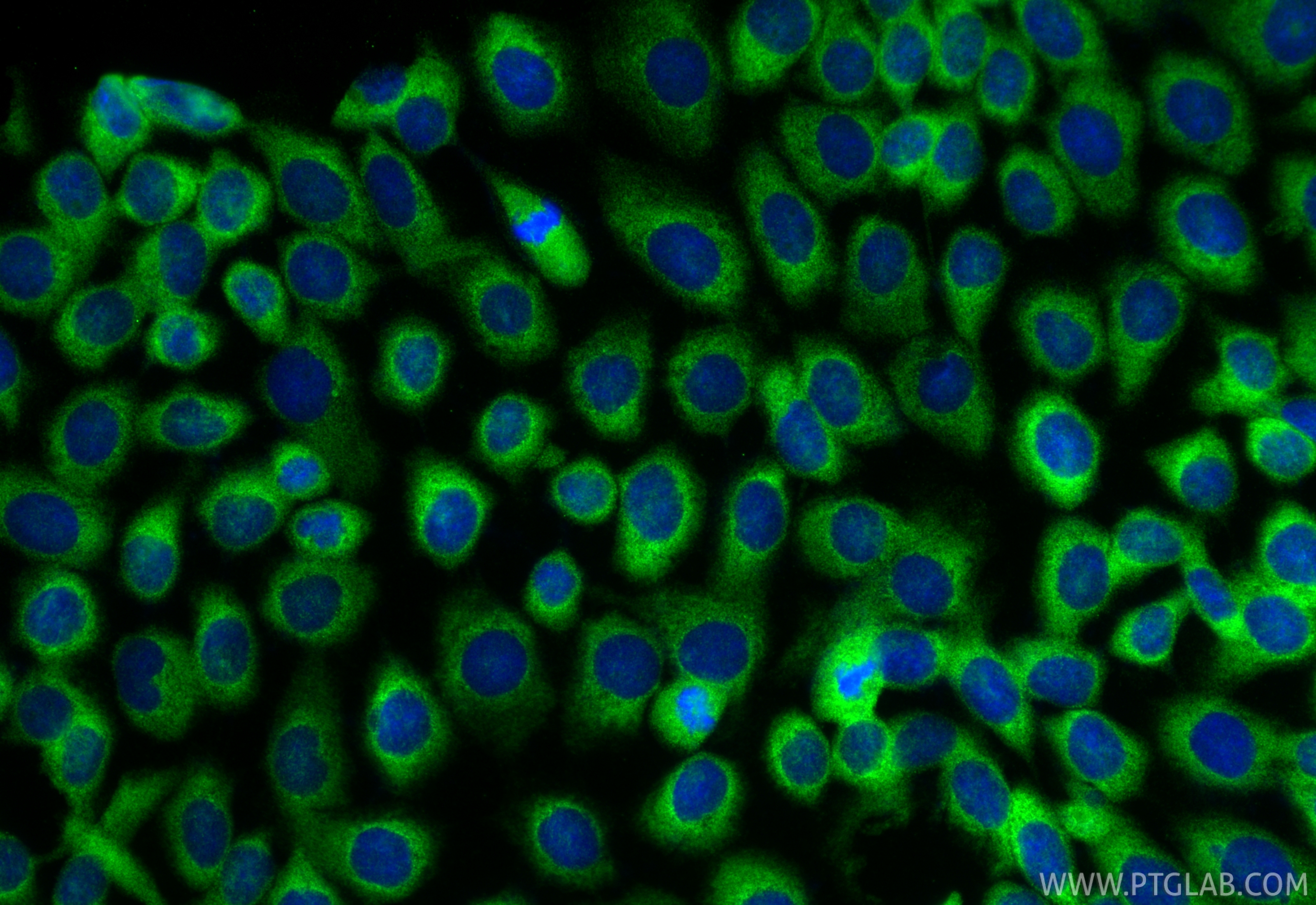 IF Staining of A431 using RMX00108 IF Staining of A431 using RMX00108