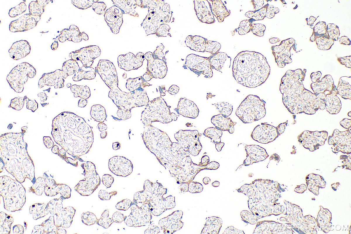 IHC staining of human placenta using RMX00108 IHC staining of human placenta using RMX00108