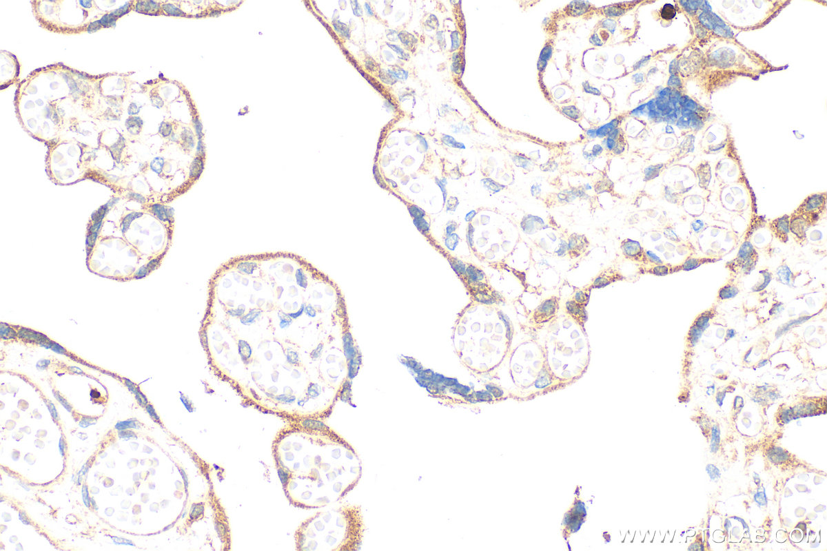 IHC staining of human placenta using RMX00108 IHC staining of human placenta using RMX00108