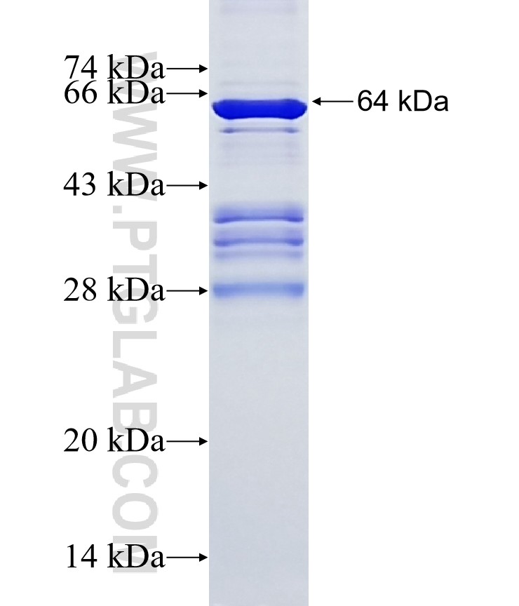 PDE4DIP fusion protein Ag3332 SDS-PAGE